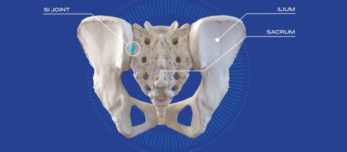 minimally-invasive-sacroiliac-joint-stabilization